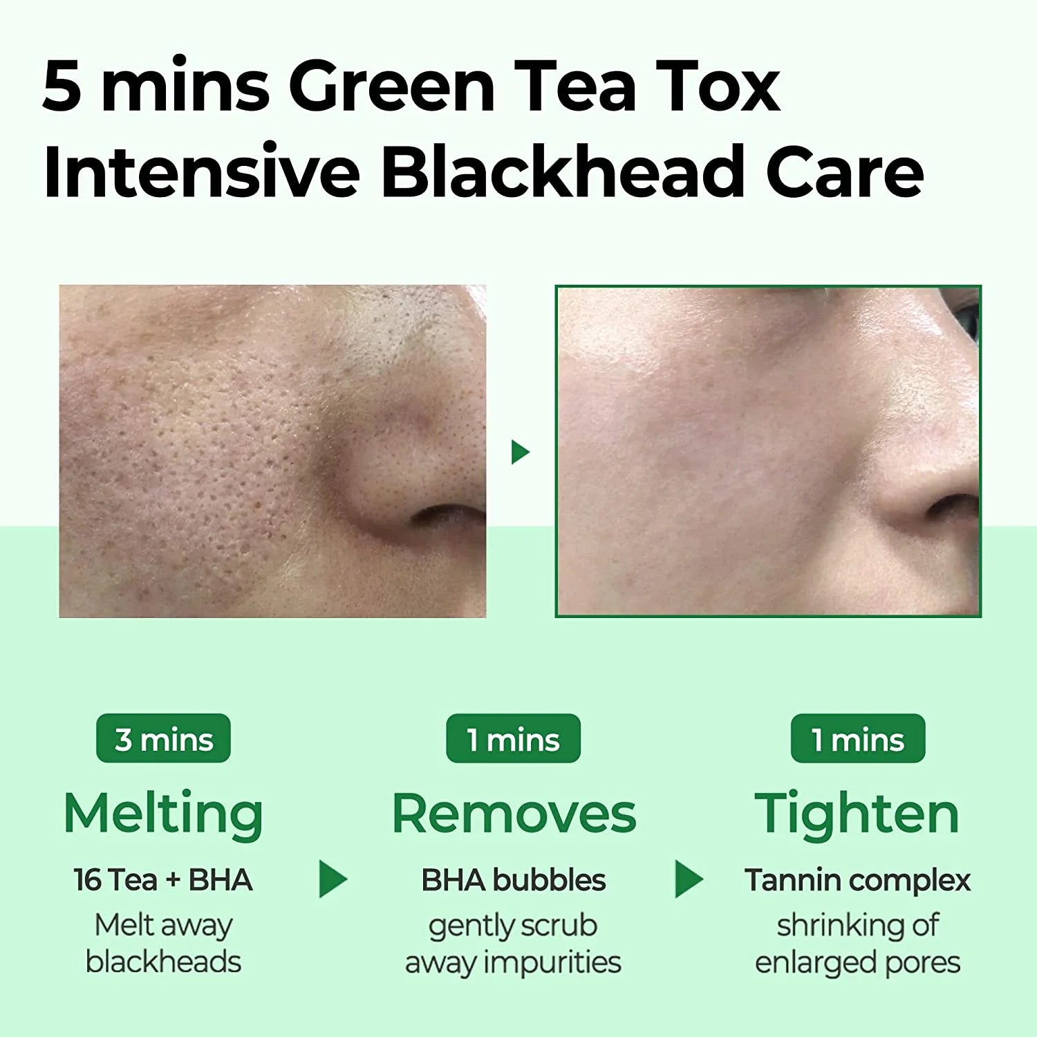 , Bye Bye Blackhead, 30 Days Miracle Green Tea Tox, Bubble Cleanser, 4.23 Oz (120 G)